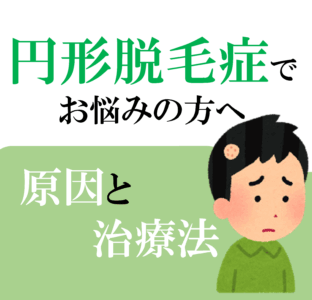 円形脱毛症の原因と治療法のアイキャッチ画像